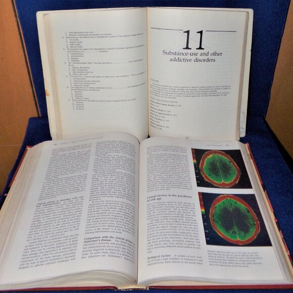 Abnormal Psychology and Modern Life James Coleman, James Butcher Text & Workbook - Picture 5 of 5